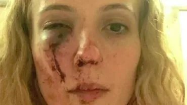 O ROMÂNCĂ a fost BĂTUTĂ cu BESTIALITATE de mai mulți ADOLESCENȚI, în fața locuinței sale din Marea Britanie (FOTO)