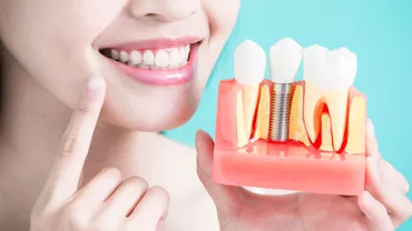 Clinica stomatologica - servicii cu plata in rate pentru pacientii cu probleme dentare