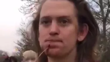 Metoda incredibilă folosită de un tânăr rugbist pentru a trata o tăietură suferită în timpul meciului (VIDEO)