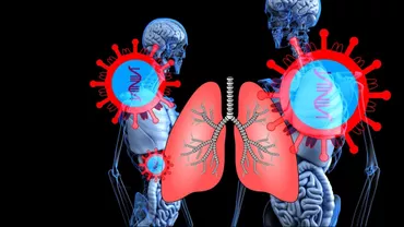 CORONAVIRUS | Mărturie cutremurătoare a unui medic italian: ”Trebuie să alegem pe cine intubăm dintre un pacient de 40 de ani și unul de 60 de ani care riscă, amândoi, să moară”