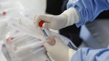 Încă 5 români au murit din cauza epidemiei de coronavirus. Cea mai tânără victimă avea 39 de ani. Bilanțul a ajuns la 524 decese