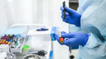 Peste 3,5 milioane de oameni s-au vindecat de coronavirus la nivel mondial. Bilanțul deceselor se apropie de 410.000. Evoluția pandemiei. LIVE UPDATE