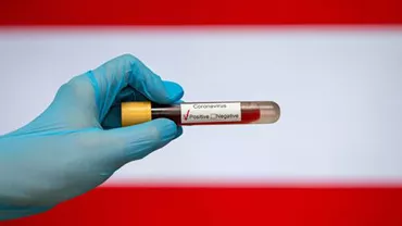 EXCLUSIV // COVID-19: Peste un sfert din numărul testelor raportate marți au fost efectuate în București. La cât a ajuns numărul deceselor în Capitală de la începutul pandemiei