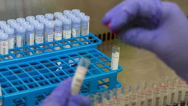 CORONAVIRUS | Record în România: Peste 100 de noi decese în rândul pacienților cu COVID-19. 4.724 de noi îmbolnăviri în 24 de ore. 824 de pacienți sunt internați la ATI