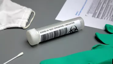 CORONAVIRUS | Aproape 9.500 de noi îmbolnăviri în 24 de ore. 1.149 de pacienți sunt internați la ATI și alți 174 au murit