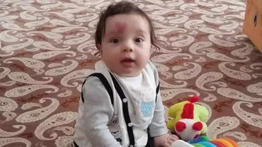 S-a născut cu o inimă pe frunte. La vârsta de 4 ani, i-a șocat pe toți! E incredibil ce s-a întâmplat copilului