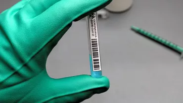 Eroarea de fabricație care a afectat testele pentru vaccinul Oxford-AstraZeneca