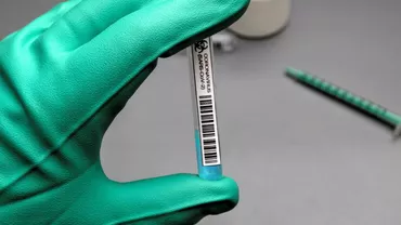 CORONAVIRUS | 213 noi decese în rândul pacienților cu COVID-19. Peste 7.400 de noi cazuri de infectare din aproape 30.000 de teste. 1.276 de persoane, internate la ATI