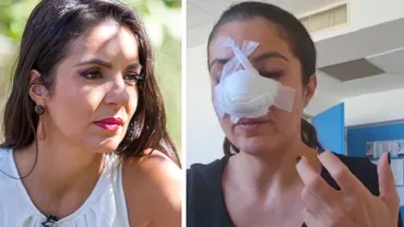 Cristina Joia a fost operată pentru a doua oară la nas, ca urmare a loviturii primite într-un magazin din Capitală