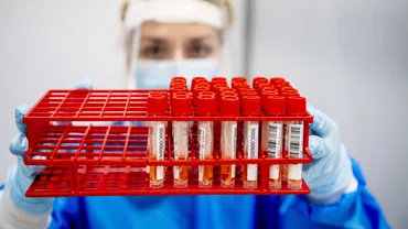 4.637 de cazuri noi de COVID-19 și 135 de decese în 24 de ore / 1.162 de pacienți cu coronavirus la Terapie Intensivă