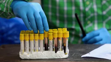 CORONAVIRUS | Marea Britanie, cel mai ridicat bilanţ zilnic al deceselor din aprilie