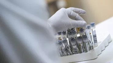 Teste false RT-PCR negative, vândute pe OLX. Autoritățile desfășoară percheziții