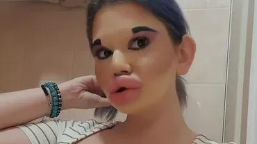 Femeia cu cele mai mari buze din lume se pregătește de o nouă intervenție estetică. Uite ce rezultate își dorește să obțină