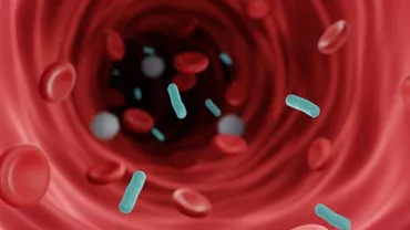 „Epidemie” de septicemie în Suedia / Ce spun specialiștii: „Asta face ca sepsisul să fie la fel de frecvent ca şi cancerul”