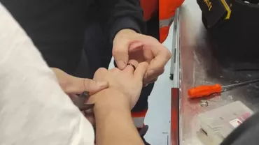 Botoșani: Un băiat a ajuns la spital pentru că nu mai putea să-și scoată inelele. Nici medicii n-au reușit, așa că au chemat pompierii (FOTO)