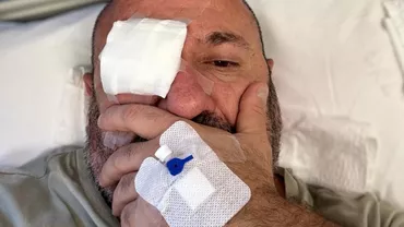 Reacția Doinei Teodoru, după ce Cătălin Scărlătescu s-a pozat în spital, cu un ochi pansat: Sunt la filmări acum...