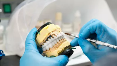 Inovația Digitală în Estetica Dentară: Revoluția Fațetelor Dentare No-Prep prin Scanare 3D și CAD/CAM